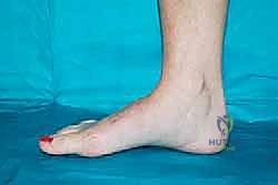 Clinical Image