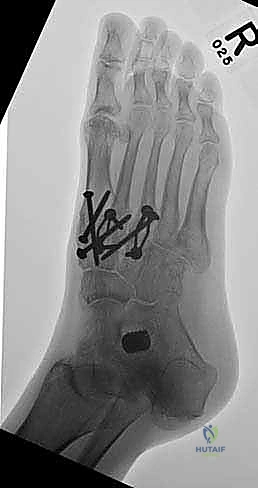 Clinical Image