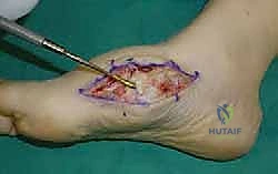 Clinical Image