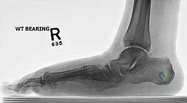 Clinical Image