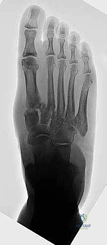 Clinical Image