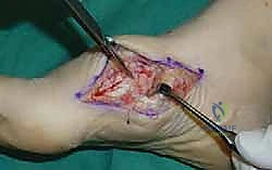 Clinical Image