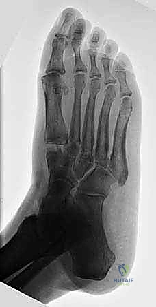 Clinical Image