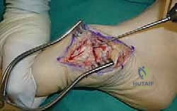Clinical Image