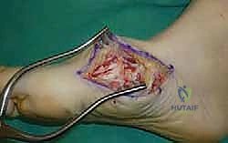 Clinical Image
