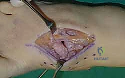 Clinical Image