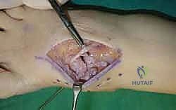 Clinical Image
