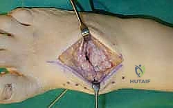 Clinical Image