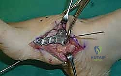 Clinical Image