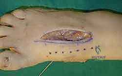 Clinical Image