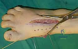 Clinical Image