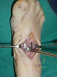 Clinical Image