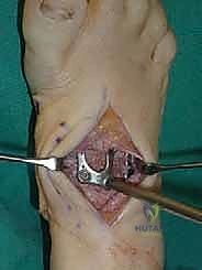 Clinical Image