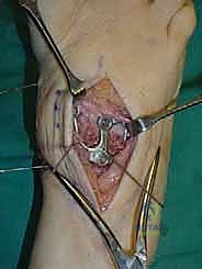 Clinical Image