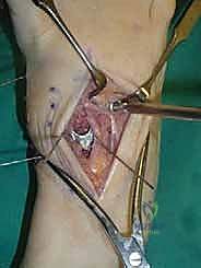 Clinical Image