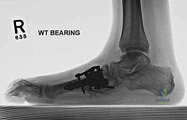 Clinical Image