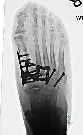 Clinical Image