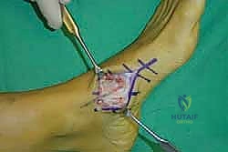 Clinical Image