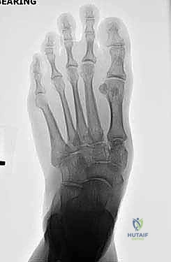 Clinical Image