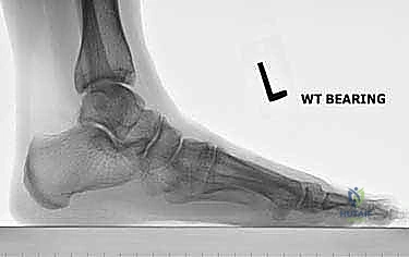 Clinical Image