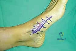 Clinical Image