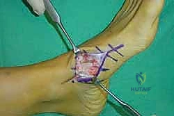 Clinical Image