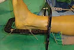 Clinical Image