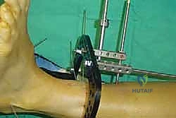 Clinical Image