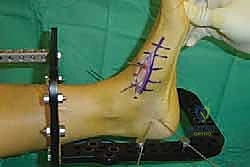 Clinical Image