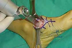 Clinical Image