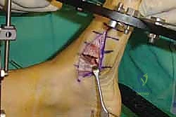 Clinical Image
