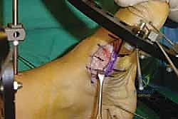 Clinical Image