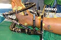 Clinical Image