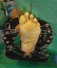 Clinical Image