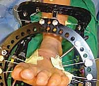 Clinical Image