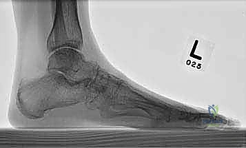 Clinical Image