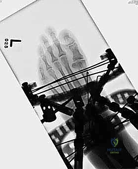 Clinical Image
