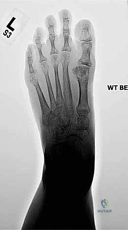 Clinical Image