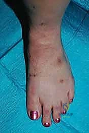 Clinical Image