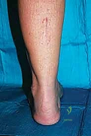 Clinical Image
