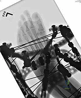 Clinical Image