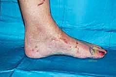 Clinical Image