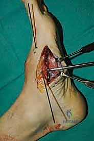 Clinical Image