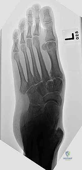 Clinical Image