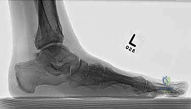 Clinical Image