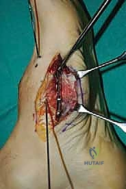 Clinical Image