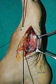 Clinical Image