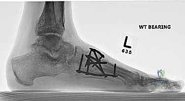 Clinical Image