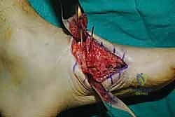 Clinical Image