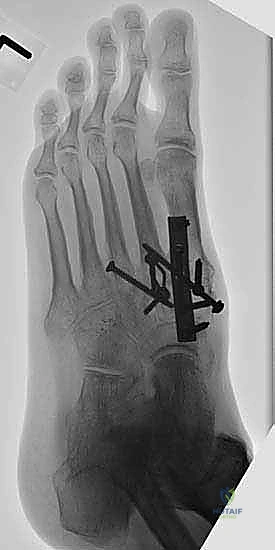 Clinical Image
